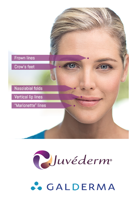 dermal-fillers-intro-image