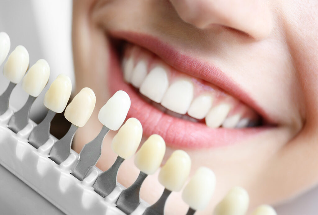 Rapid Tooth Whitening - What You Need to Know!